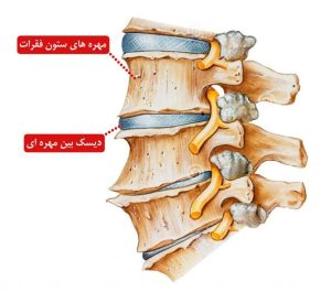 ساخت داربستی برای بافت لیفی دیسک بین مهره‌ای توسط محققان امیرک