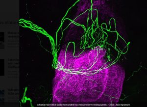 مکانیسم حسی فولیکول‌های مو شناسایی شد
